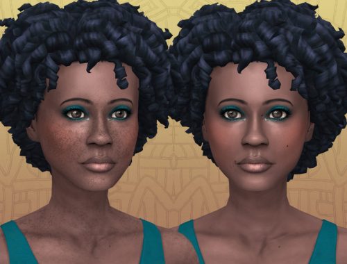 Freckles and moles for all skin colors