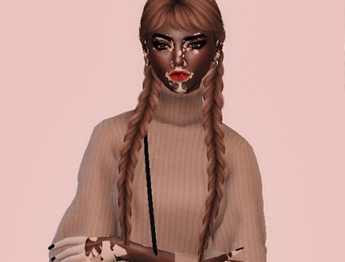 The Sims 4 | VITILIGO | Female
