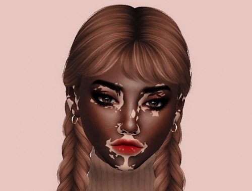 The Sims 4 | VITILIGO | Female