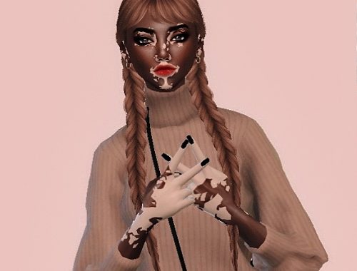 The Sims 4 | VITILIGO | Female