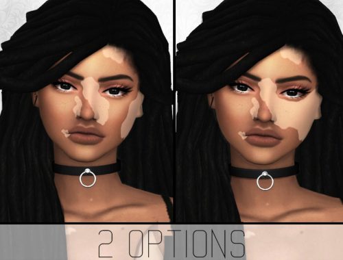 SimplyPixelated - Vitiligo Overlay