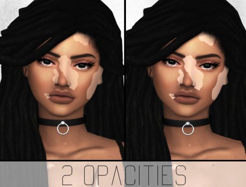 SimplyPixelated - Vitiligo Overlay