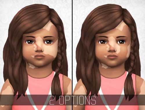 SimplyPixelated - Vitiligo Overlay - Child/Toddler