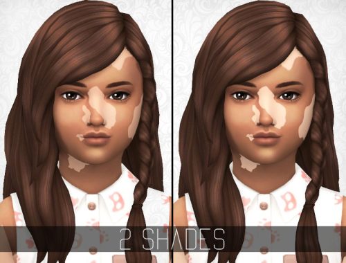 SimplyPixelated - Vitiligo Overlay - Child/Toddler