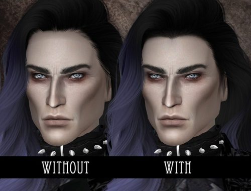 Hairline 02 - Widow's Peak