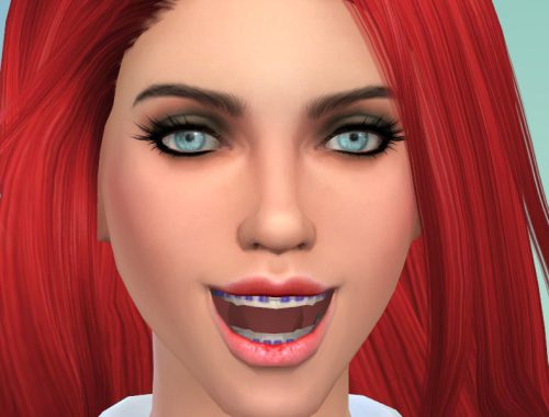 Brackets Adults V1.0