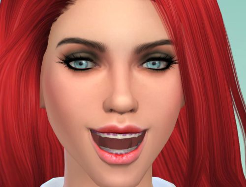 Brackets Adults V1.0