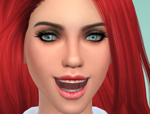 Brackets Adults V1.0