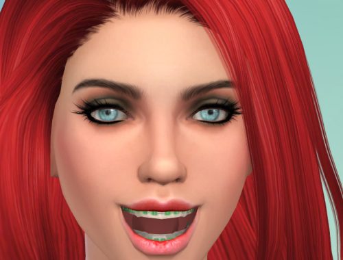 Brackets Adults V1.0