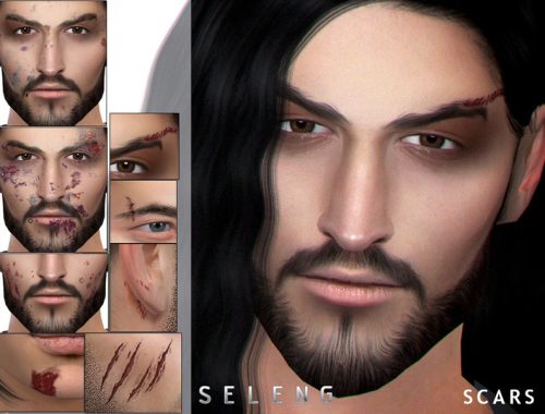 Scars