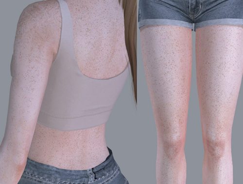 Full Body Freckles