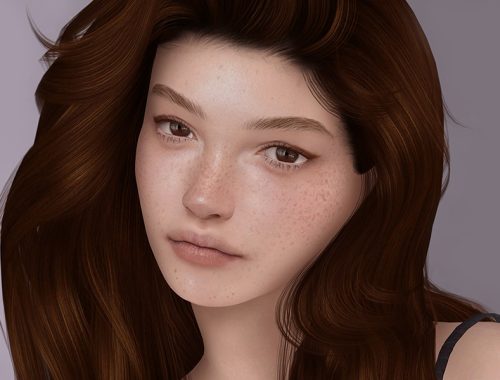 Freckles 04