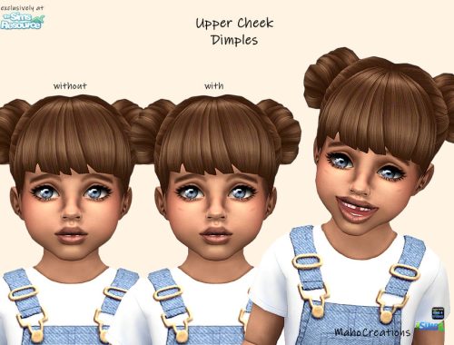 Upper Cheek Dimples