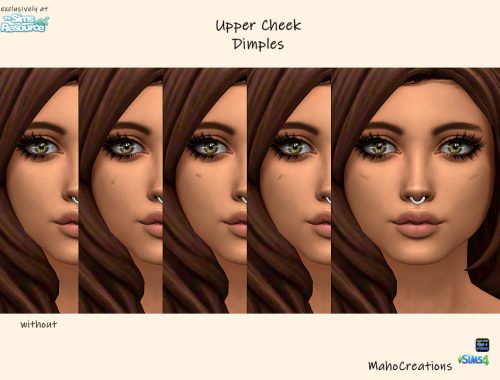 Upper Cheek Dimples